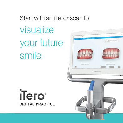 itero digital impression system